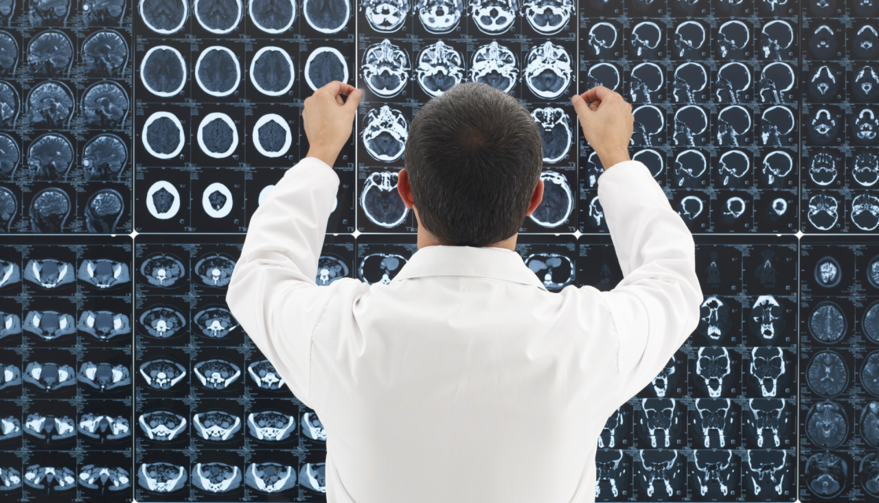 Blog - Ressonância Magnética Aberta e Claustrofobia Go Open MRI Diagnóstico por imagem profissionais de saúde qualidade e confiança
