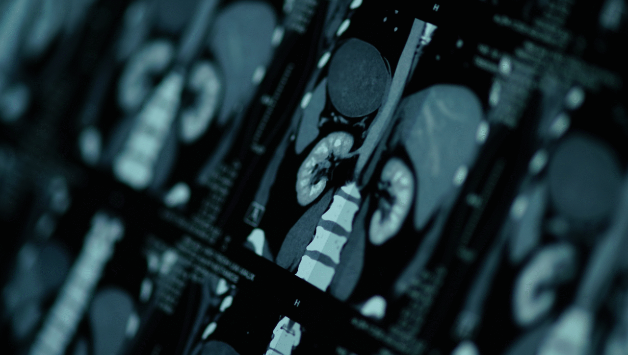 Blog - Preparação de um exame de Ressonância Magnética Aberta Go Open MRI Diagnóstico por imagem profissionais de saúde qualidade e confiança